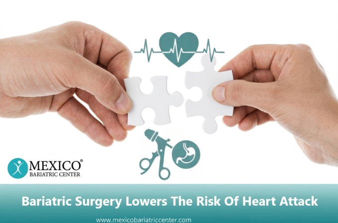 Link Between Bariatric Surgery and Heart Attack - Mexico Bariatric Center