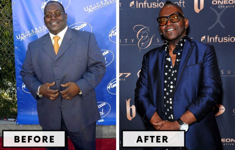 randy jackson plastic surgery Image 7